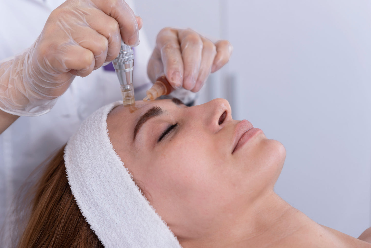 Microneedling Face