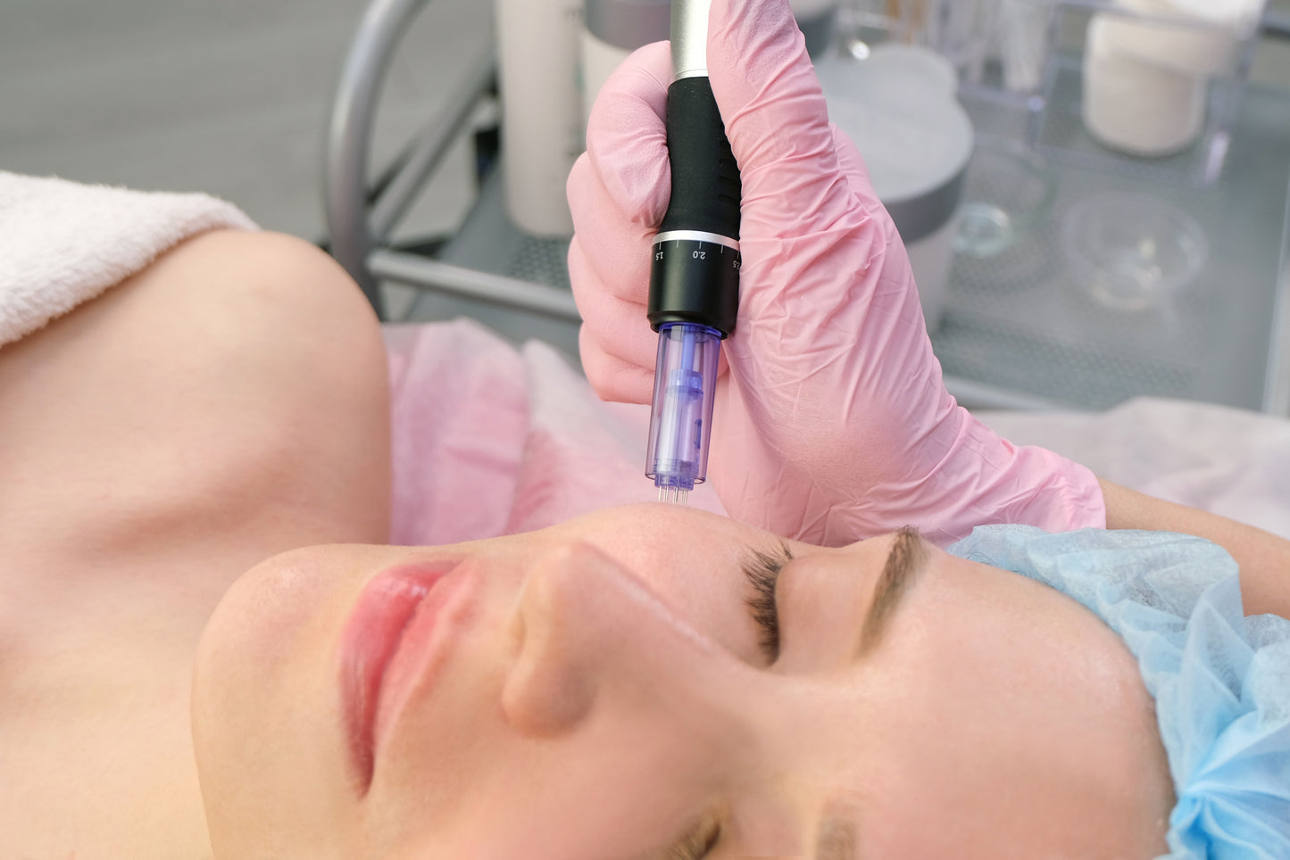 Microneedling Face