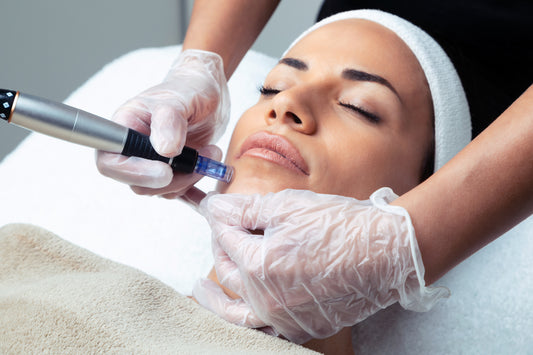 Microneedling PRP & Bio Filler