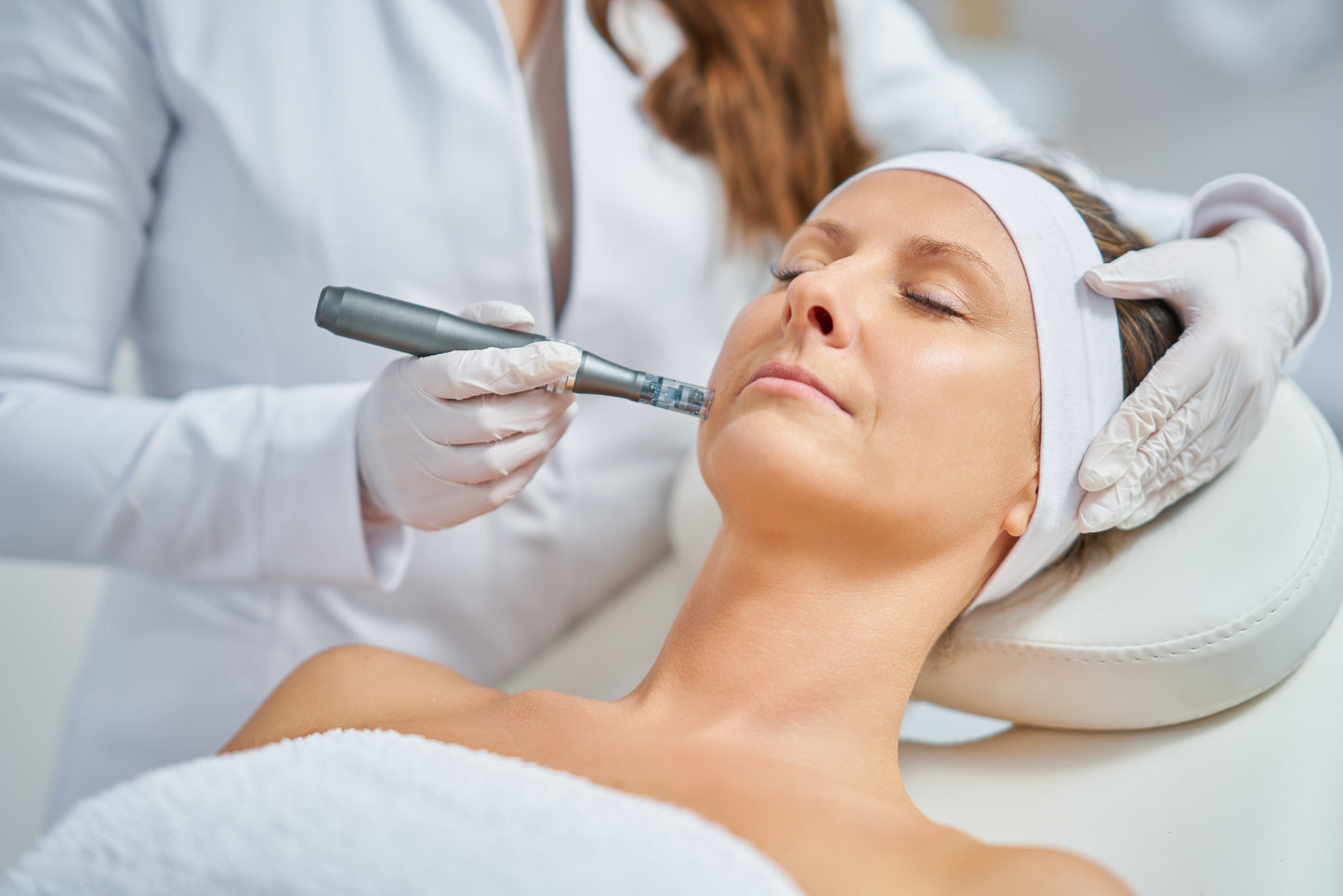 Microneedling Face