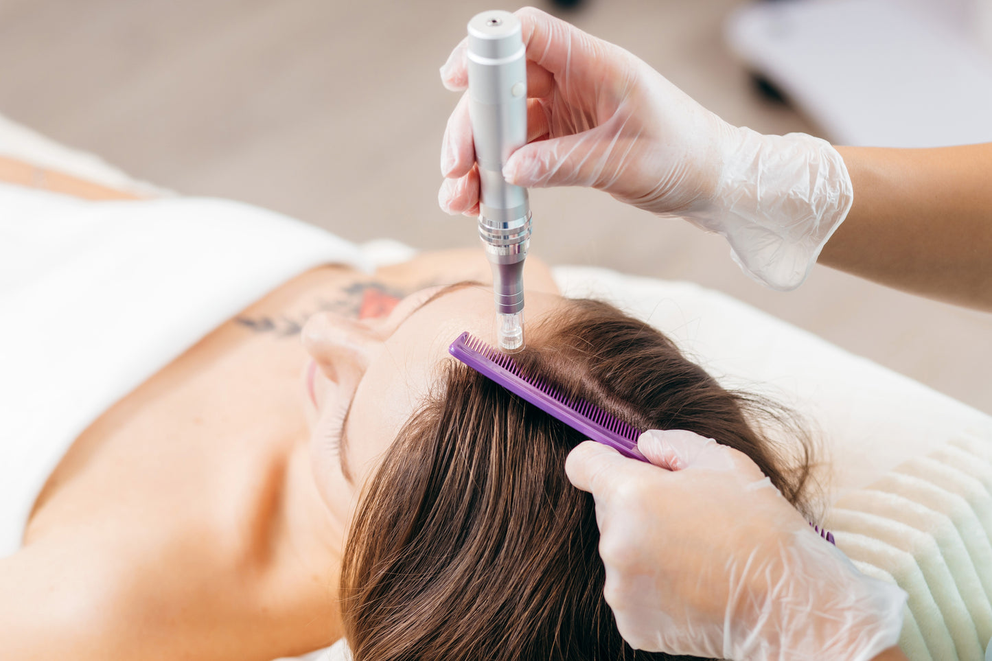 Microneedling Hair